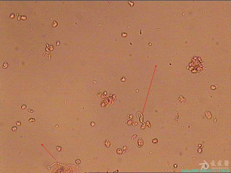 白带霉菌显微镜图片图片