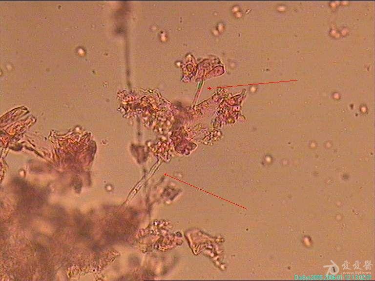 白带霉菌菌丝图片图片