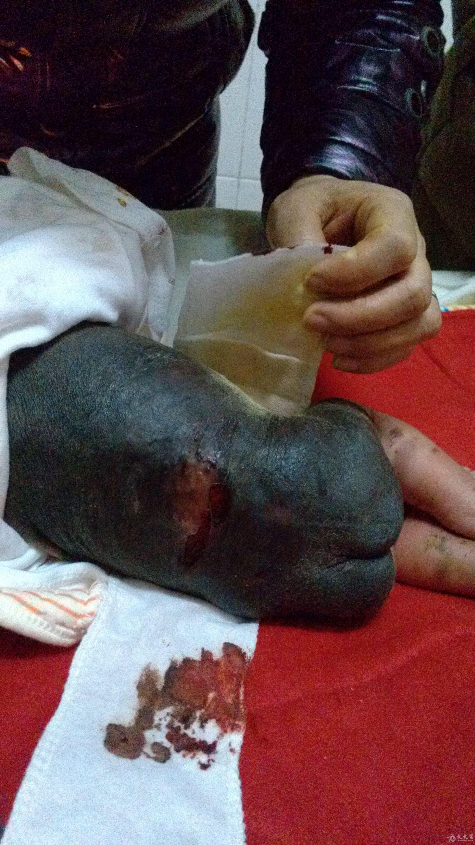 求助新生儿皮损有点恐怖值得关注的先天性色痣兽皮痣良版1218