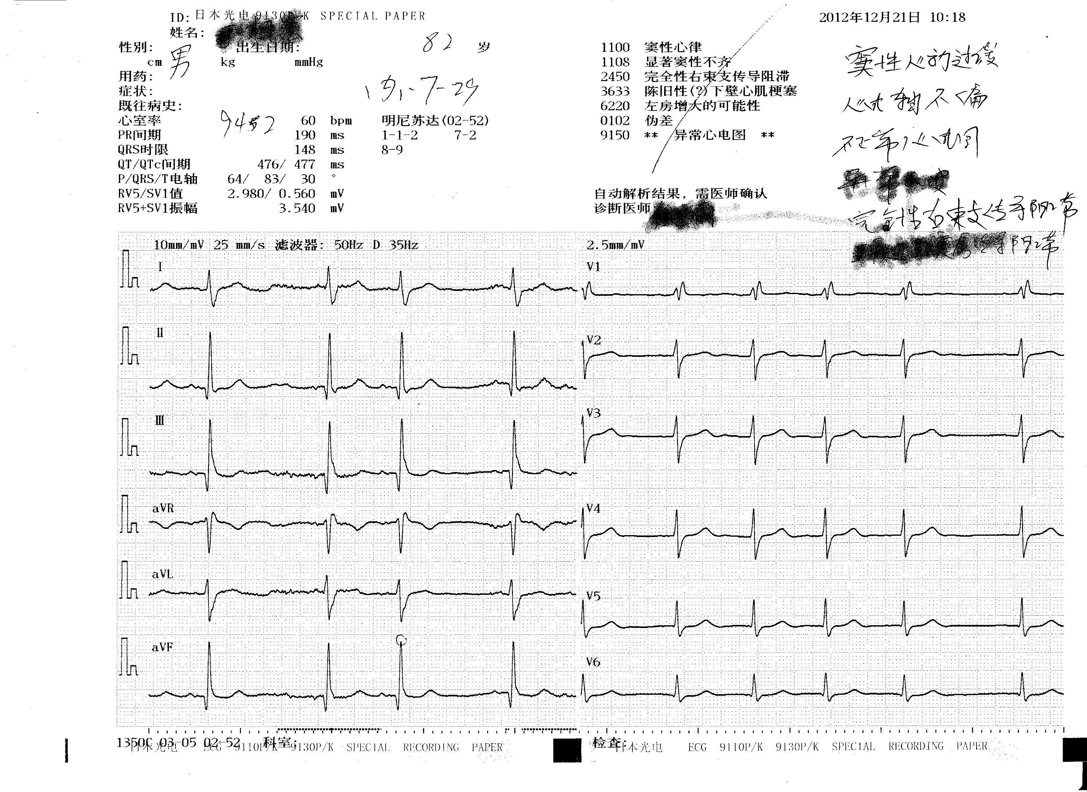 急 传了12导联图 - 心电图脑电图专业讨论版 - 爱爱医医学论坛