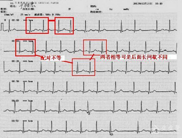 急 傳了12導聯圖 - 心電圖腦電圖專業討論版 - 愛愛醫醫學論壇