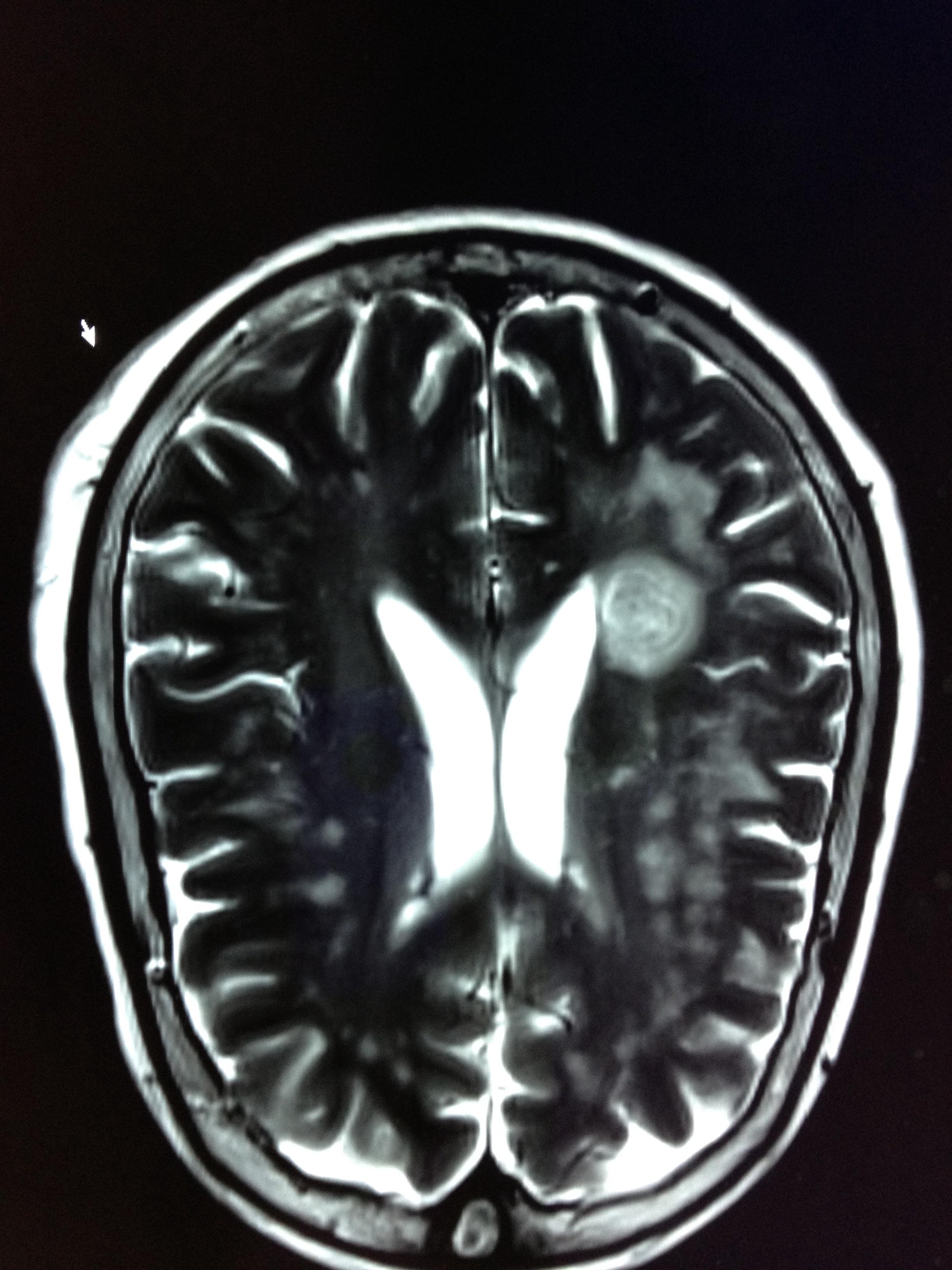mri - 医学影像学讨论版 - 爱爱医医学论坛