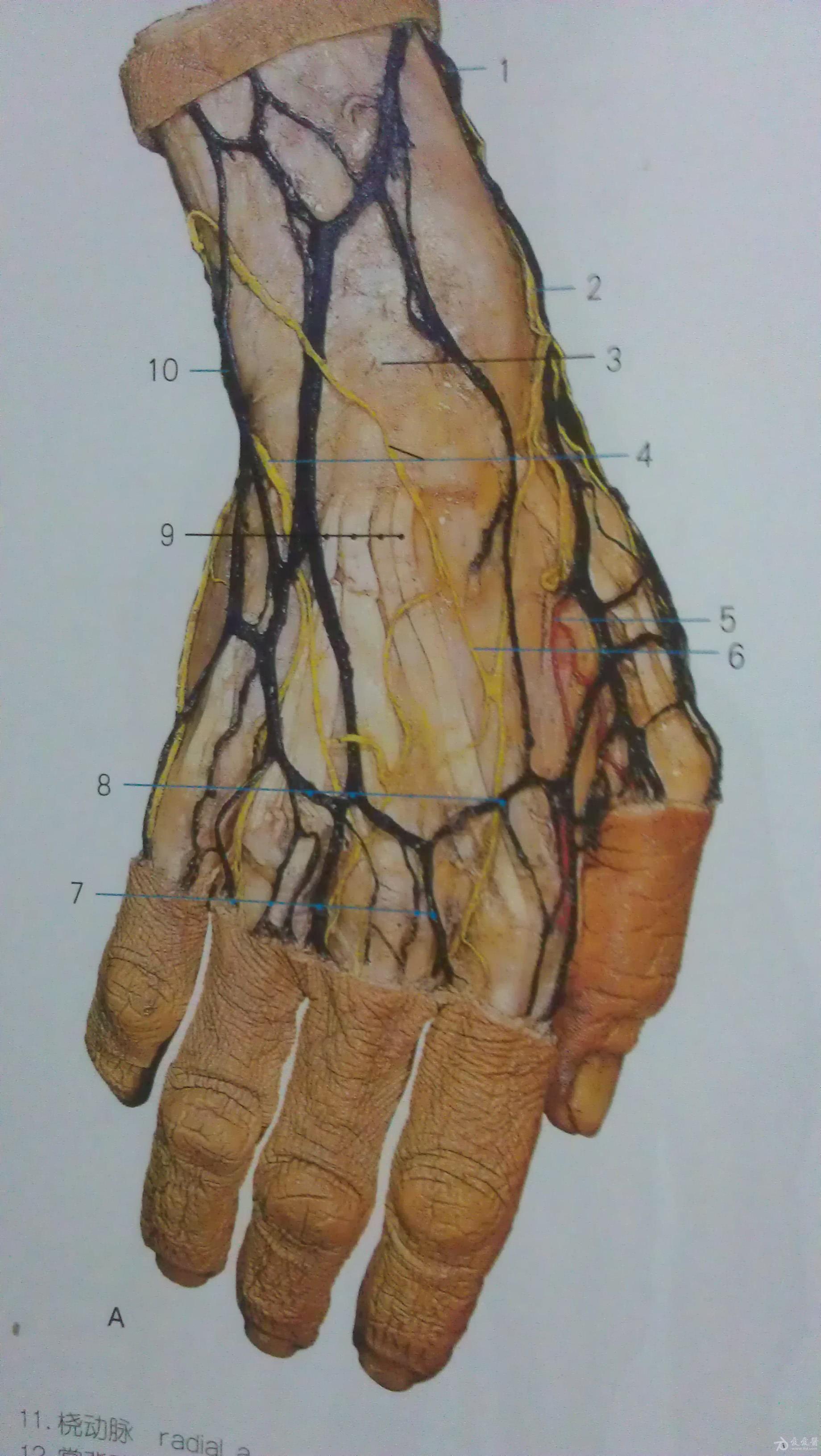手背静脉血管分布图图片