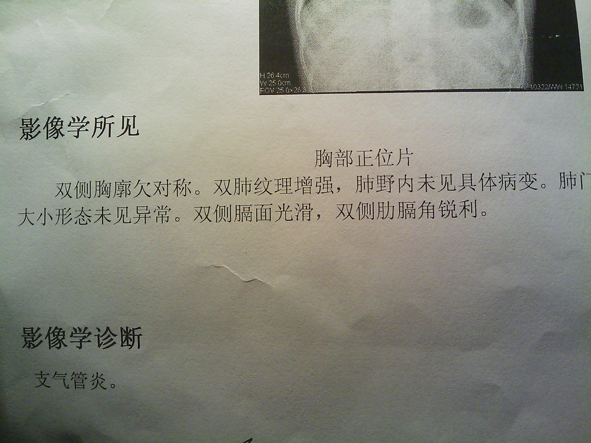 请高手给分析下这个影像报告