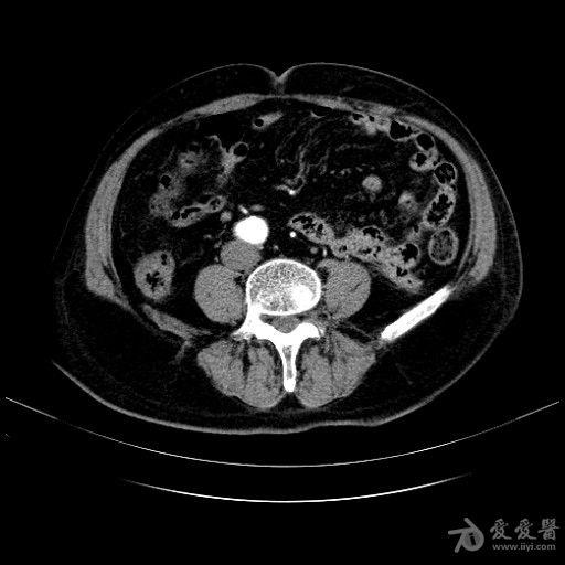 13020114018c5e428909bcd8de.jpg
