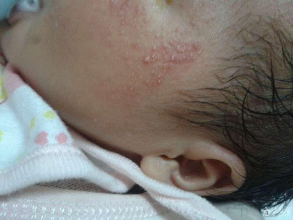 吃什么东西能让脸长胖 13021919446aa55776b7d68d84.jpg