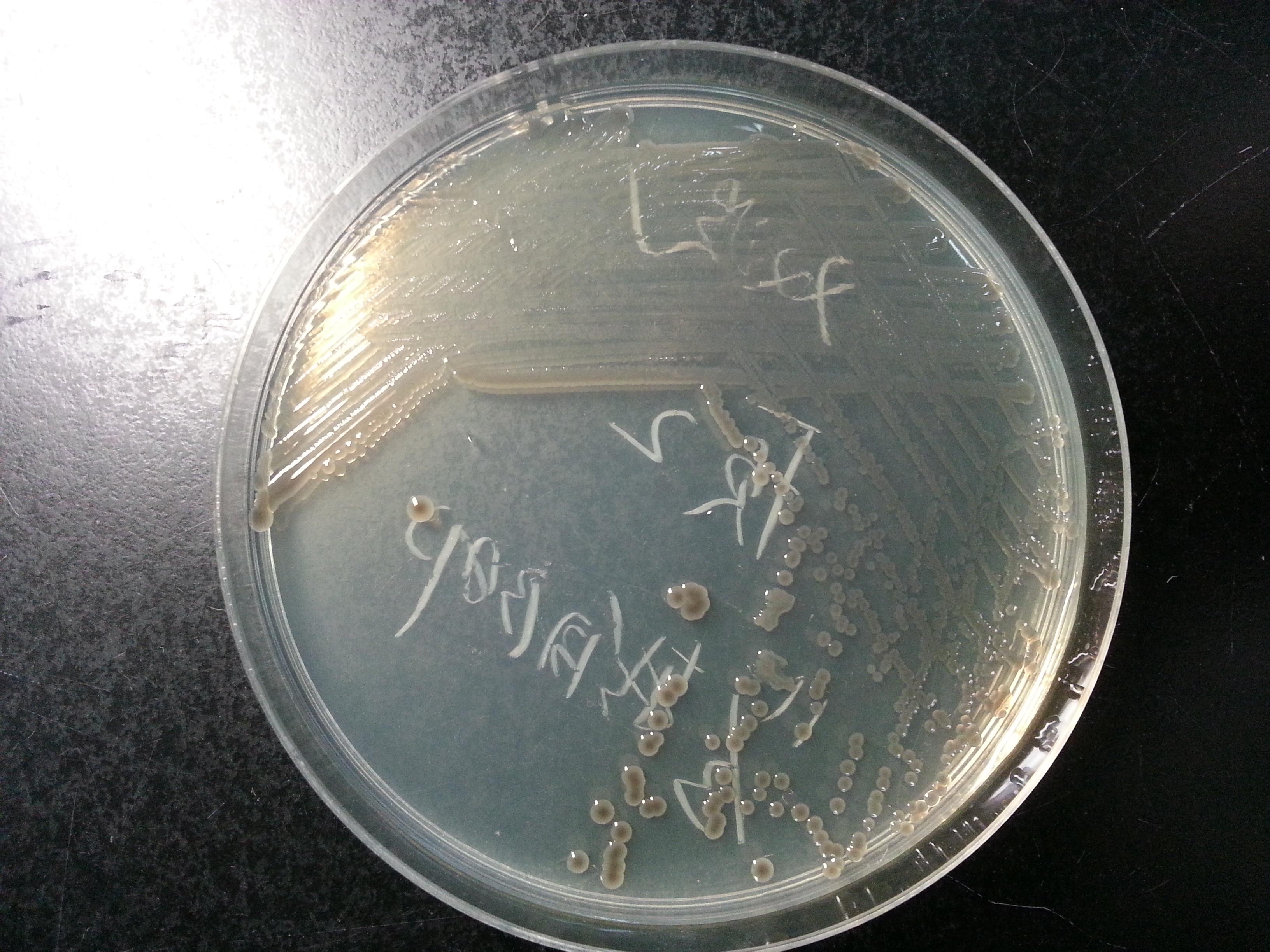 霍乱弧菌镜下图片图片