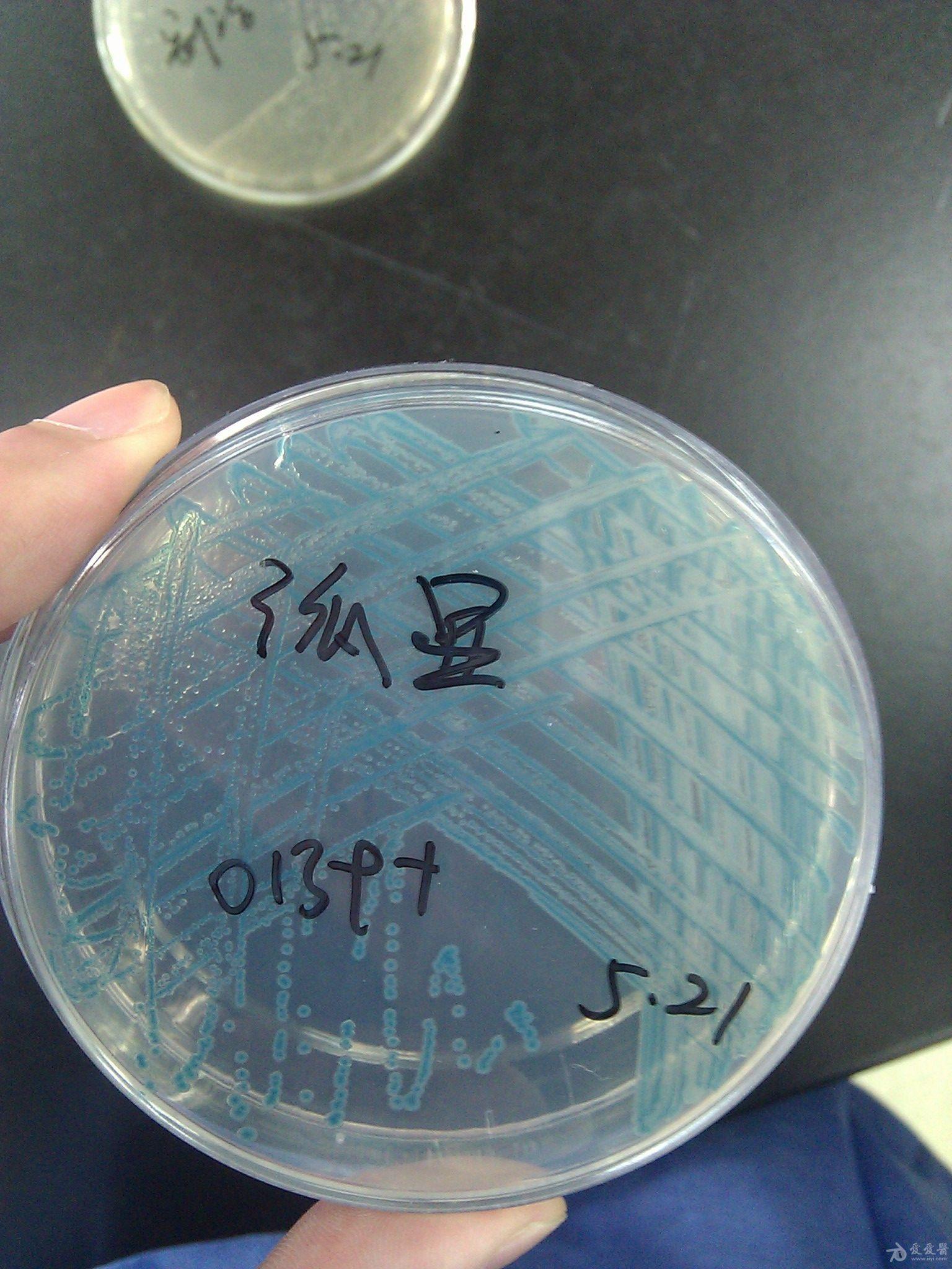 霍乱弧菌菌落形态图片及检测流程