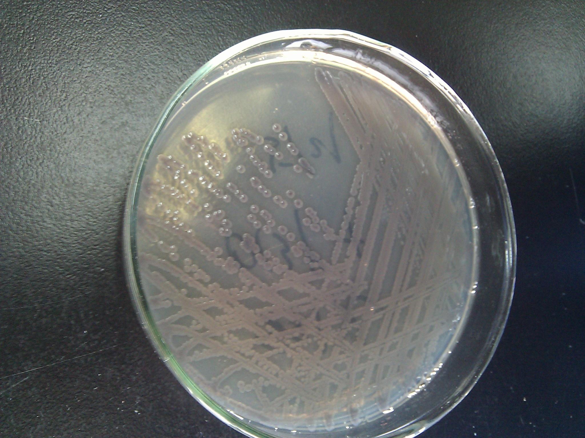 霍乱弧菌菌落形态图片及检测流程