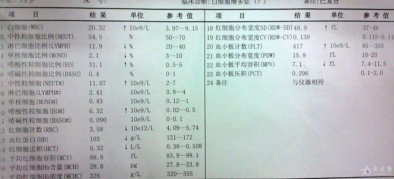 急安排到上级医院会诊,上级医院复查血常规,安排明日骨穿.