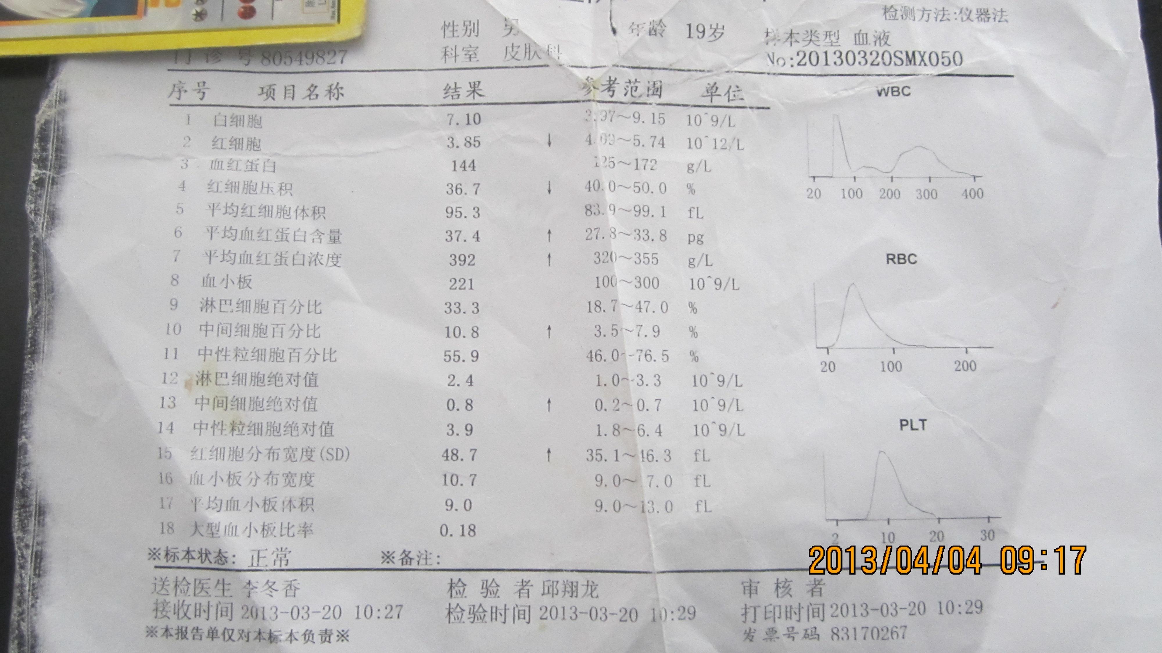 智障儿头皮皮损——《春季皮肤病病例征集》