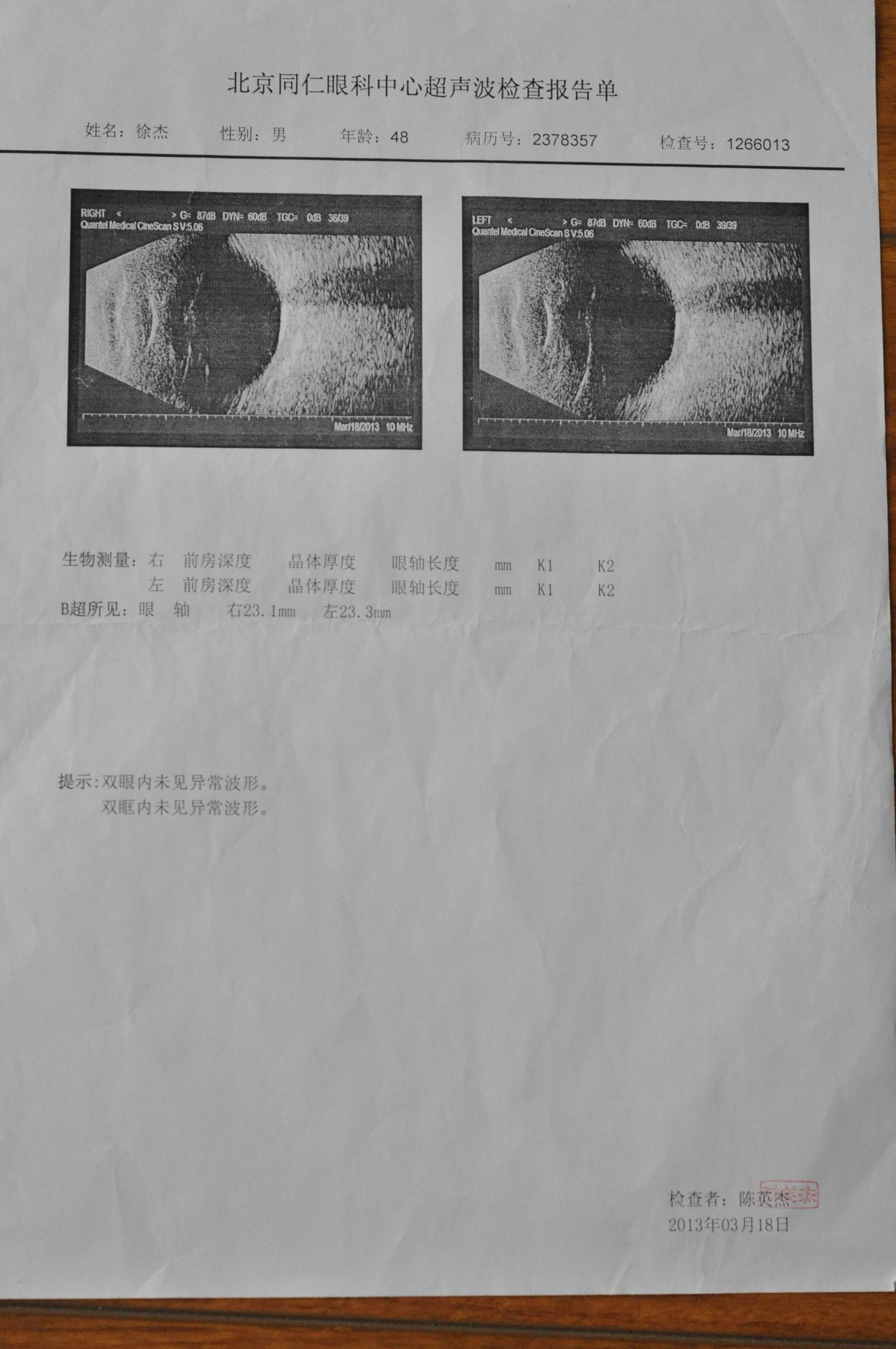 再次求助我的眼病 走了好多医院就是不好