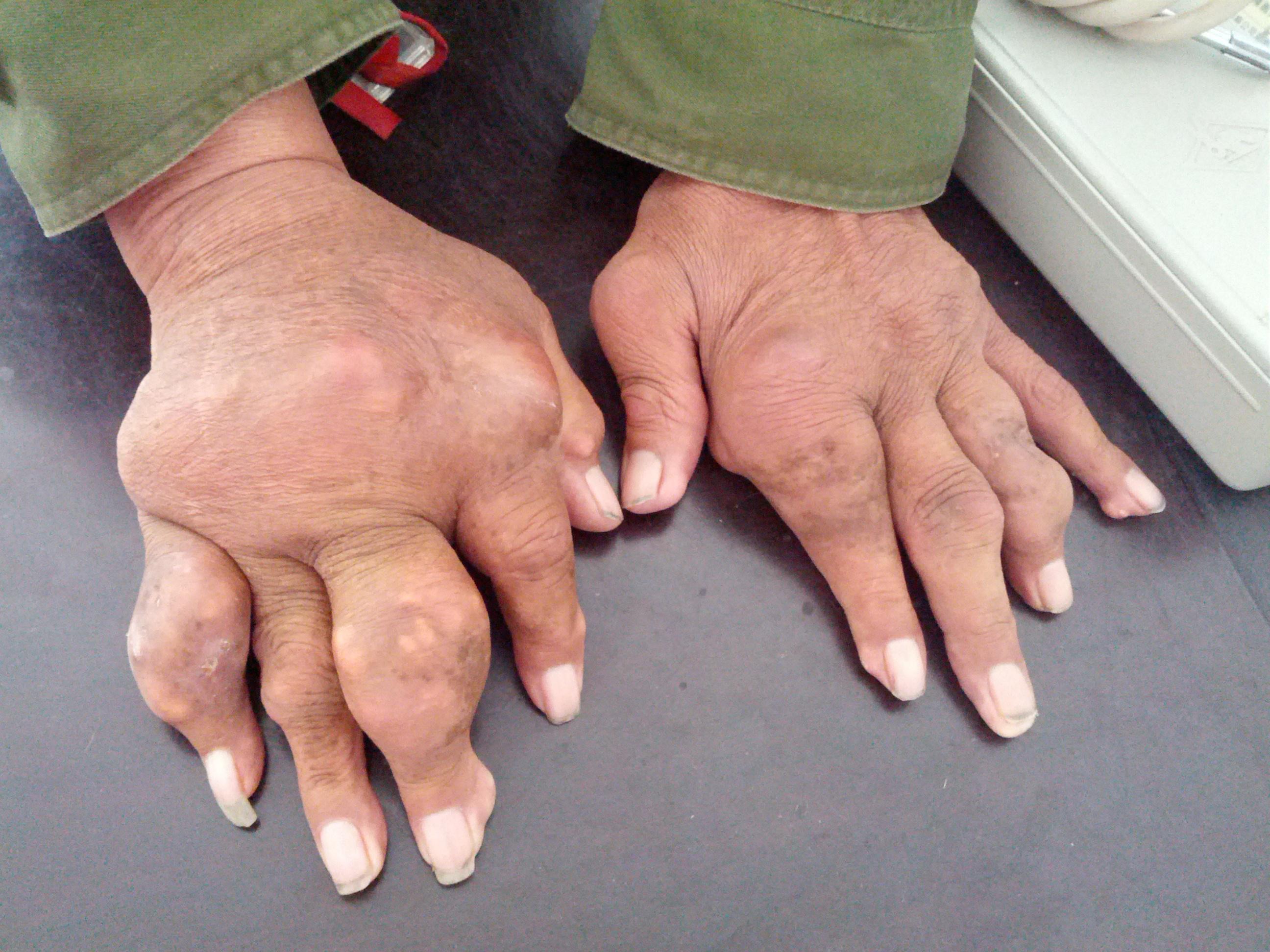 大家看一下这个病例应该采取什么治疗方法