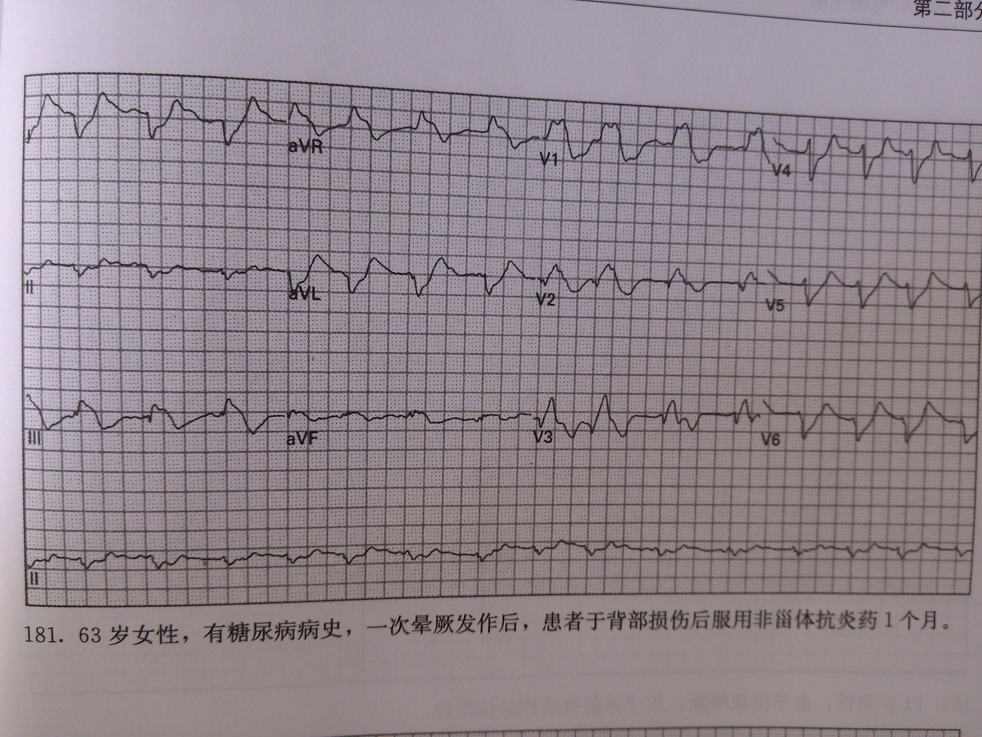 心电图脑电图专业讨论版 - 爱爱医医学论坛