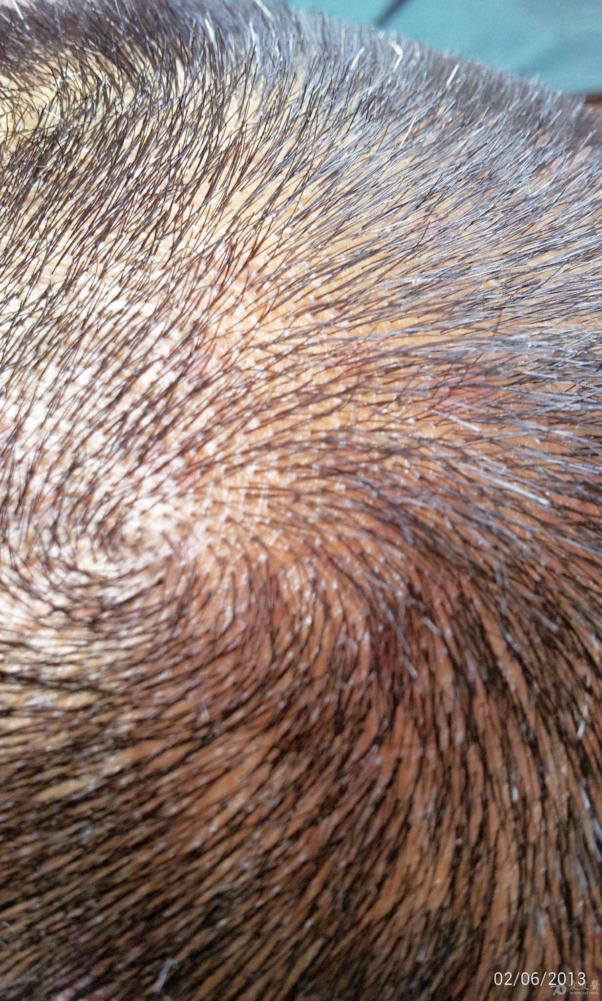 毛囊炎中医如何治疗吃些什么药或者哪2个方剂歌配合