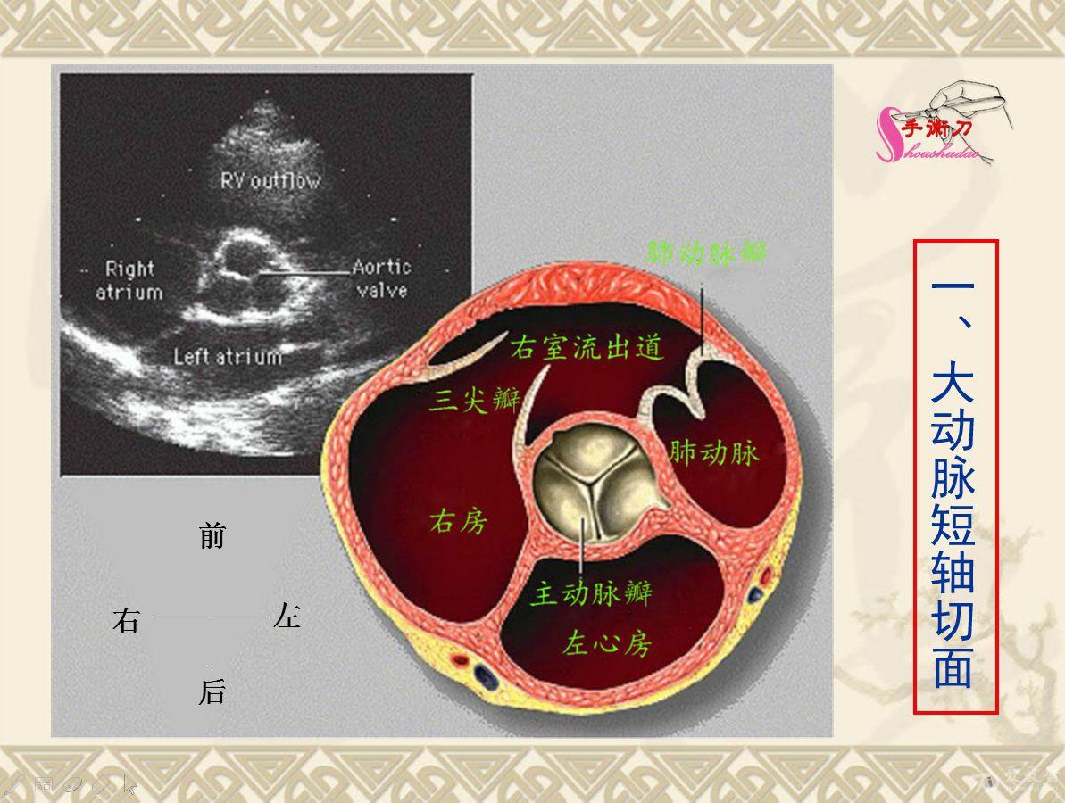 超声心动图基础切面打法图解(初学者可参考)