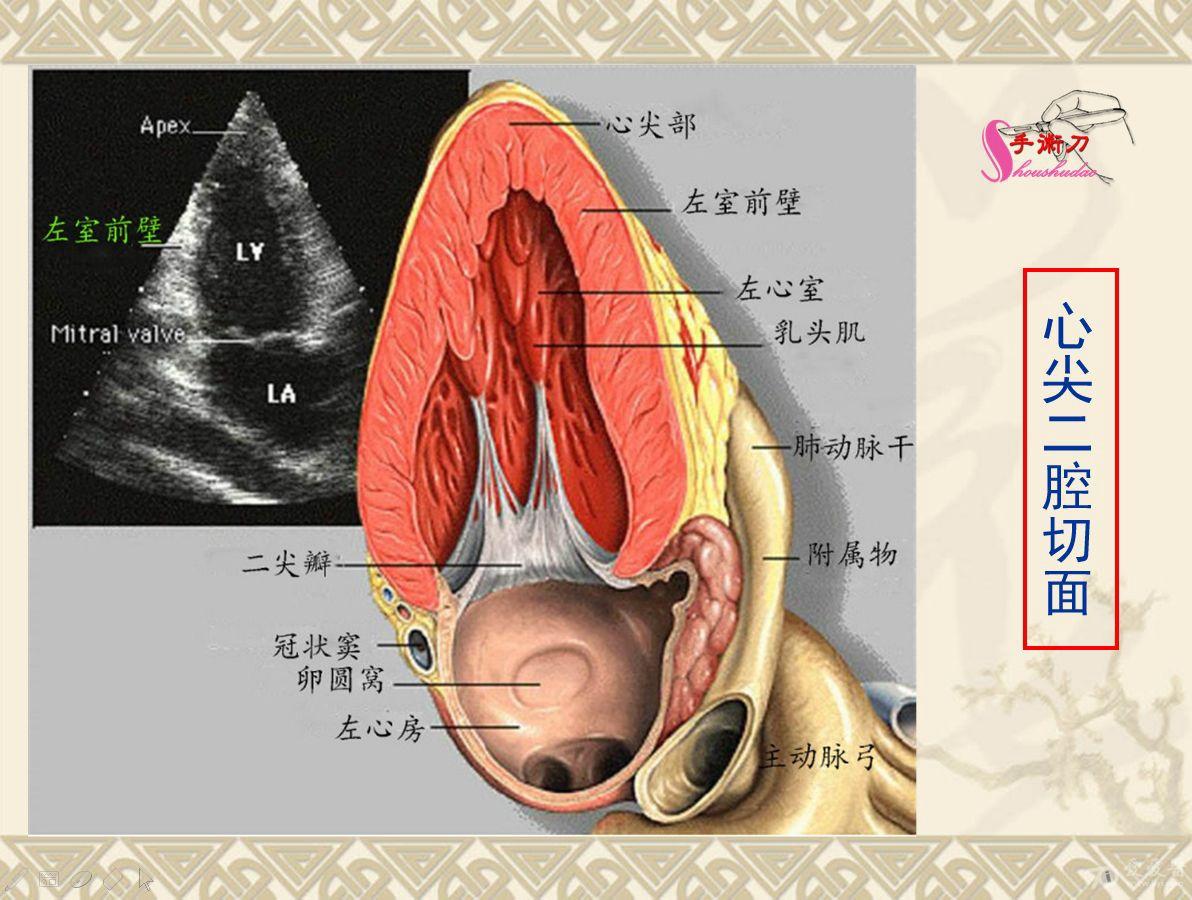 常规二维超声心动图图片