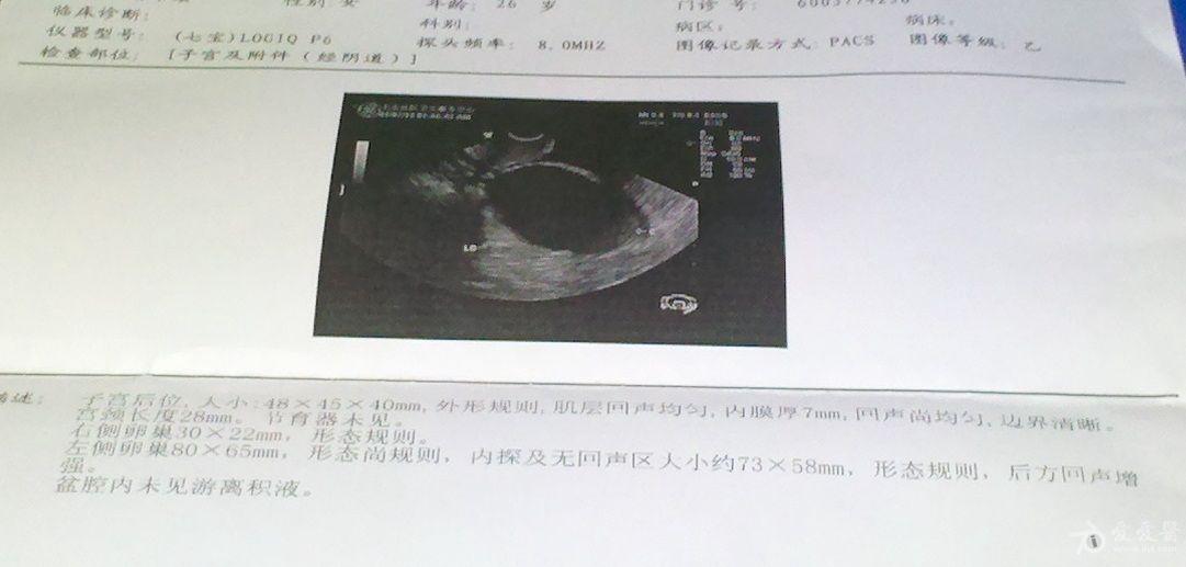 皮脂腺囊肿不管它会变大吗 130609090905bbb8ecb31b26cc.jpg