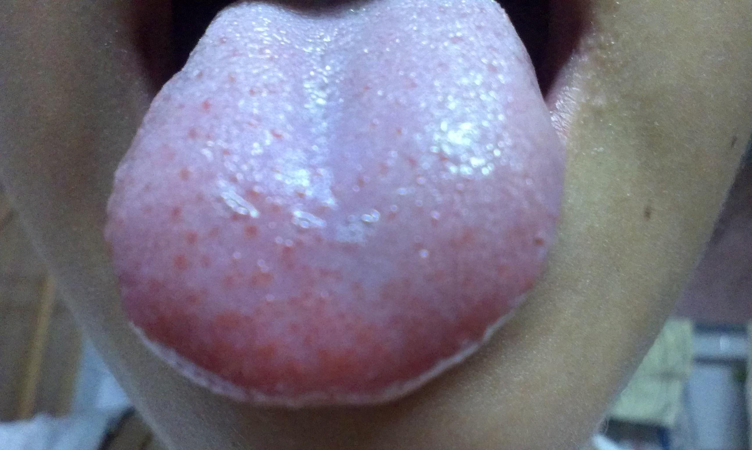 老感觉有大便拉不出来 感觉有大便但就放个屁