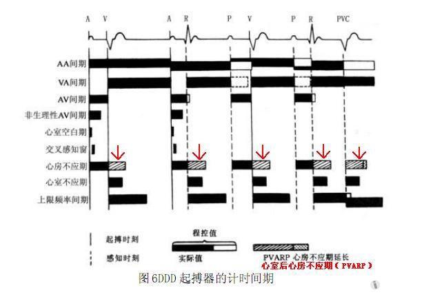 请教心室后房不应期是什么意思