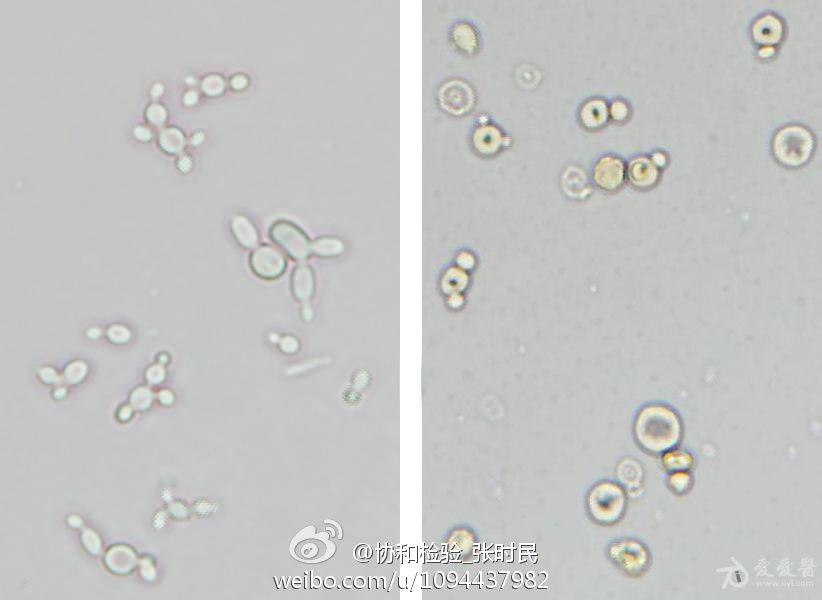 白带霉菌显微镜图片图片
