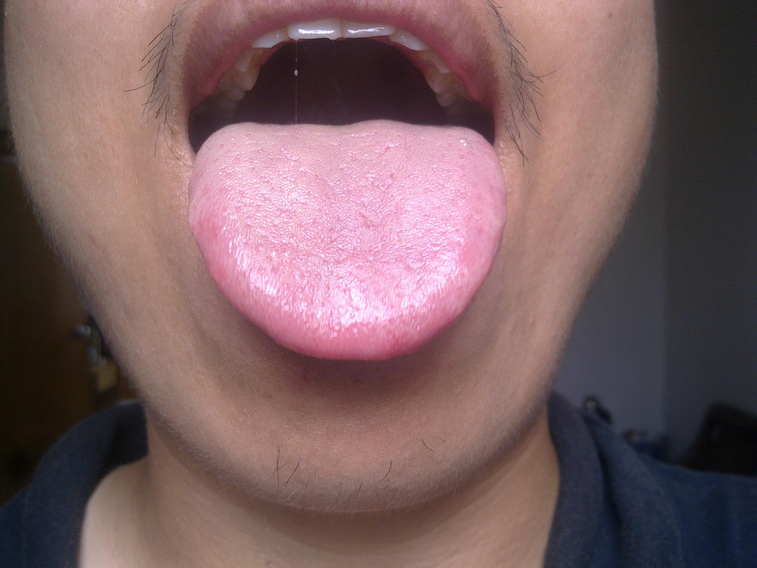 中医：从舌头看健康，舌象分析，常见的6种舌苔问题！和调理建议 - 知乎