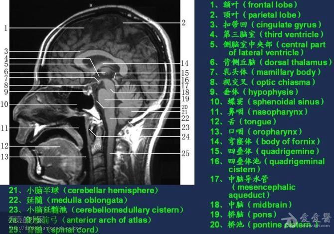 头颅mri解析