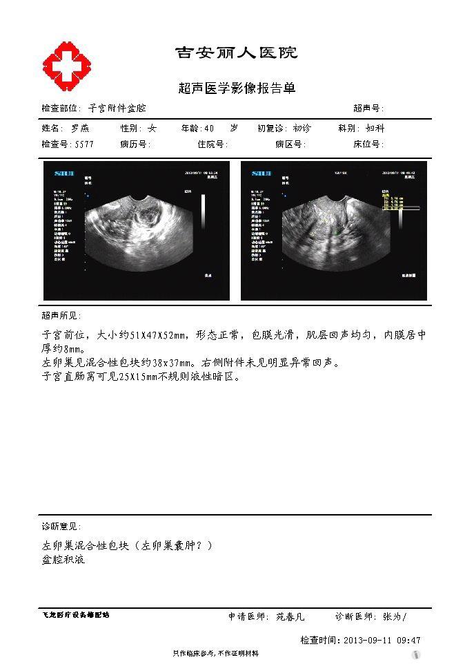 卵巢囊腺瘤超声图片图片