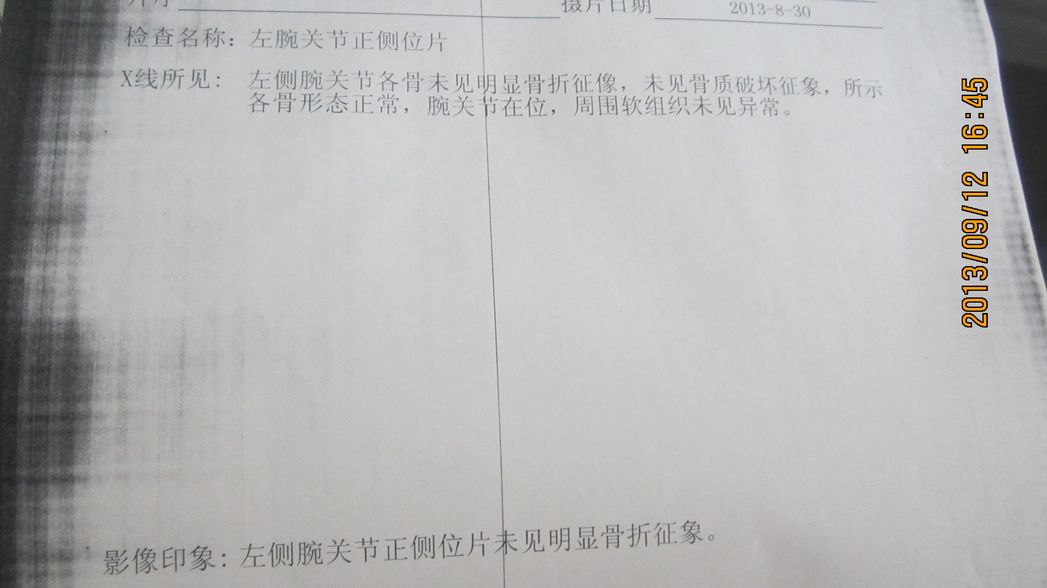 左手腕关节外伤
