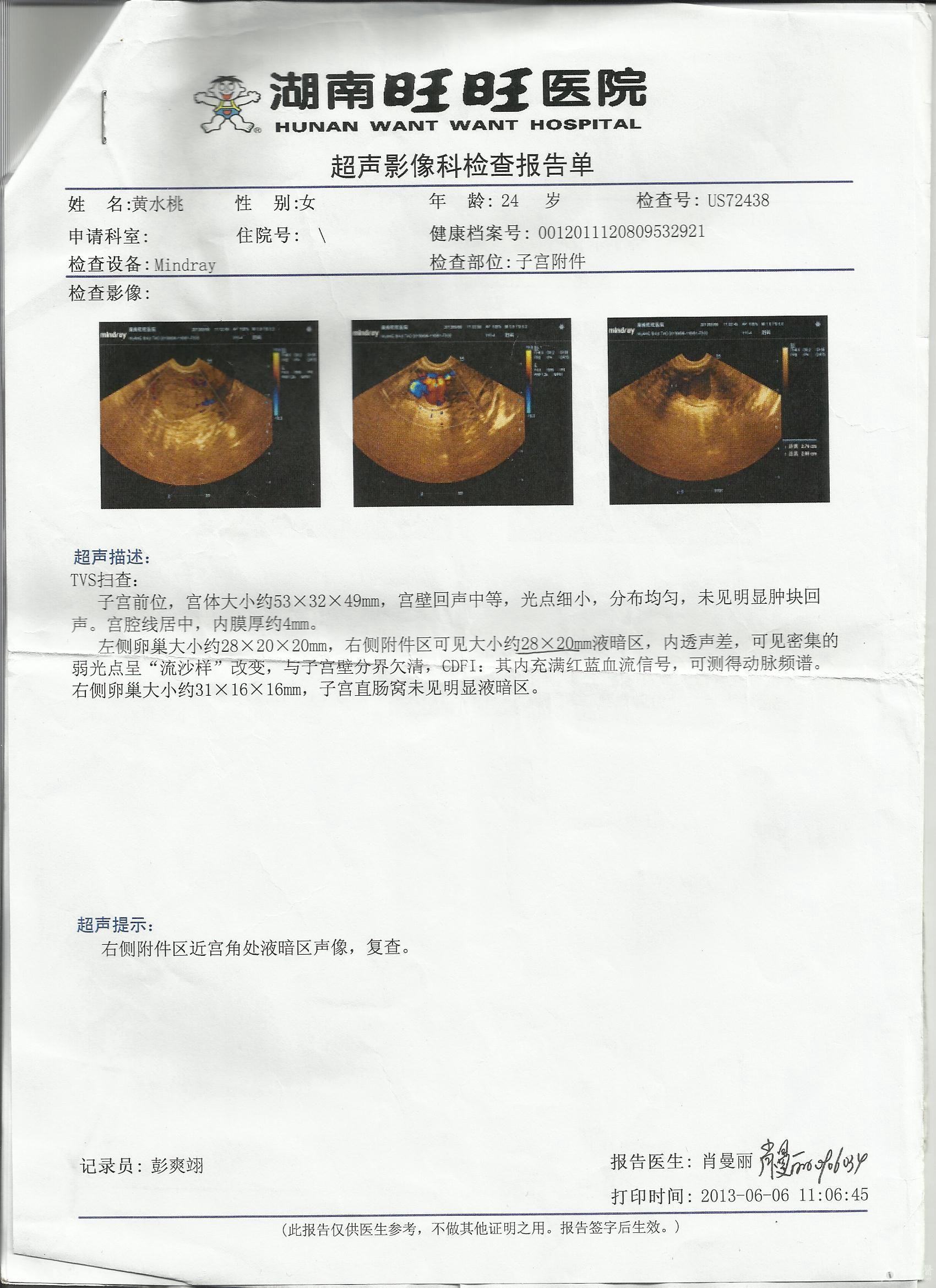 葡萄胎最佳清宫时间图片