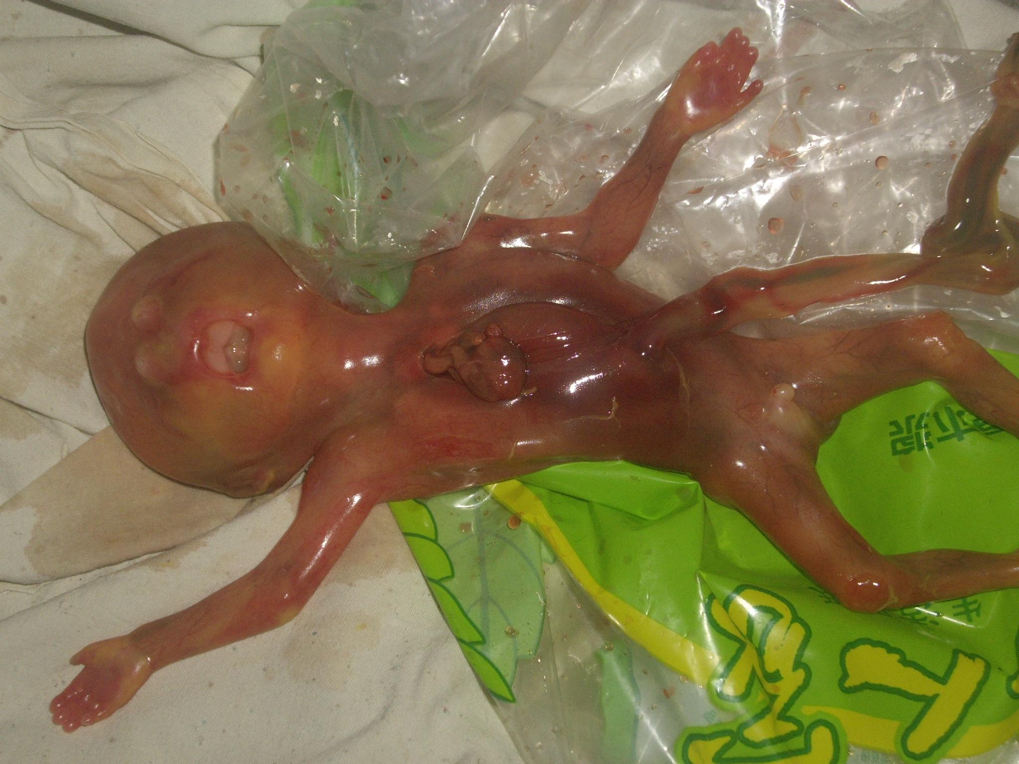 65天胎儿的真实照片图片