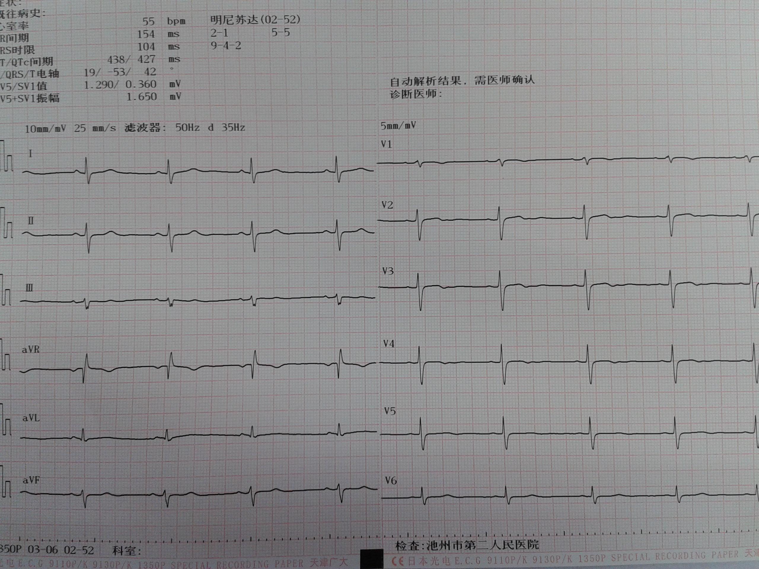 心电图脑电图专业讨论版 - 爱爱医医学论坛