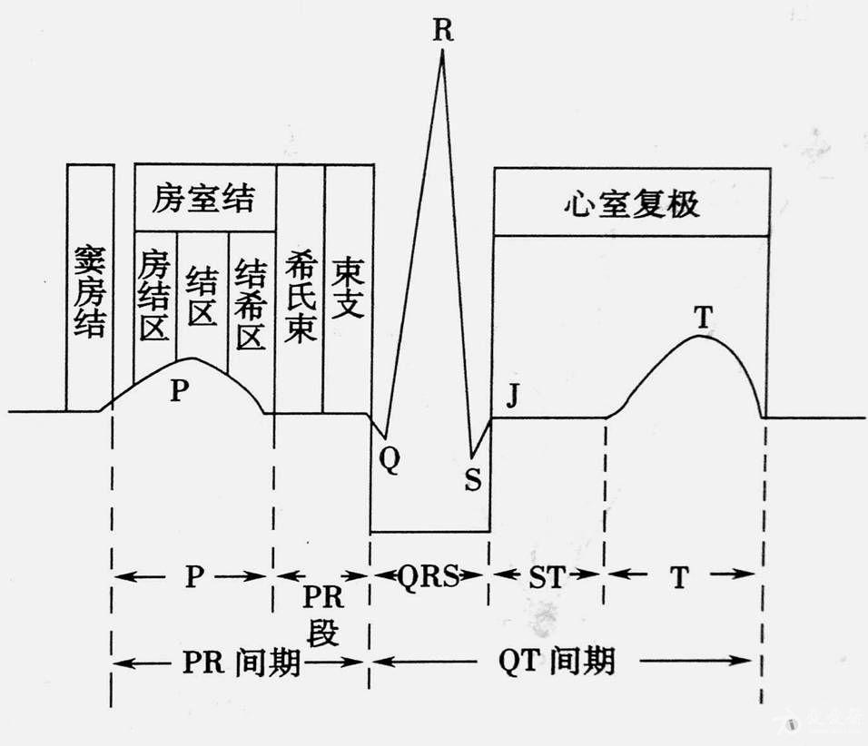 请教关于心电图j点上抬问题