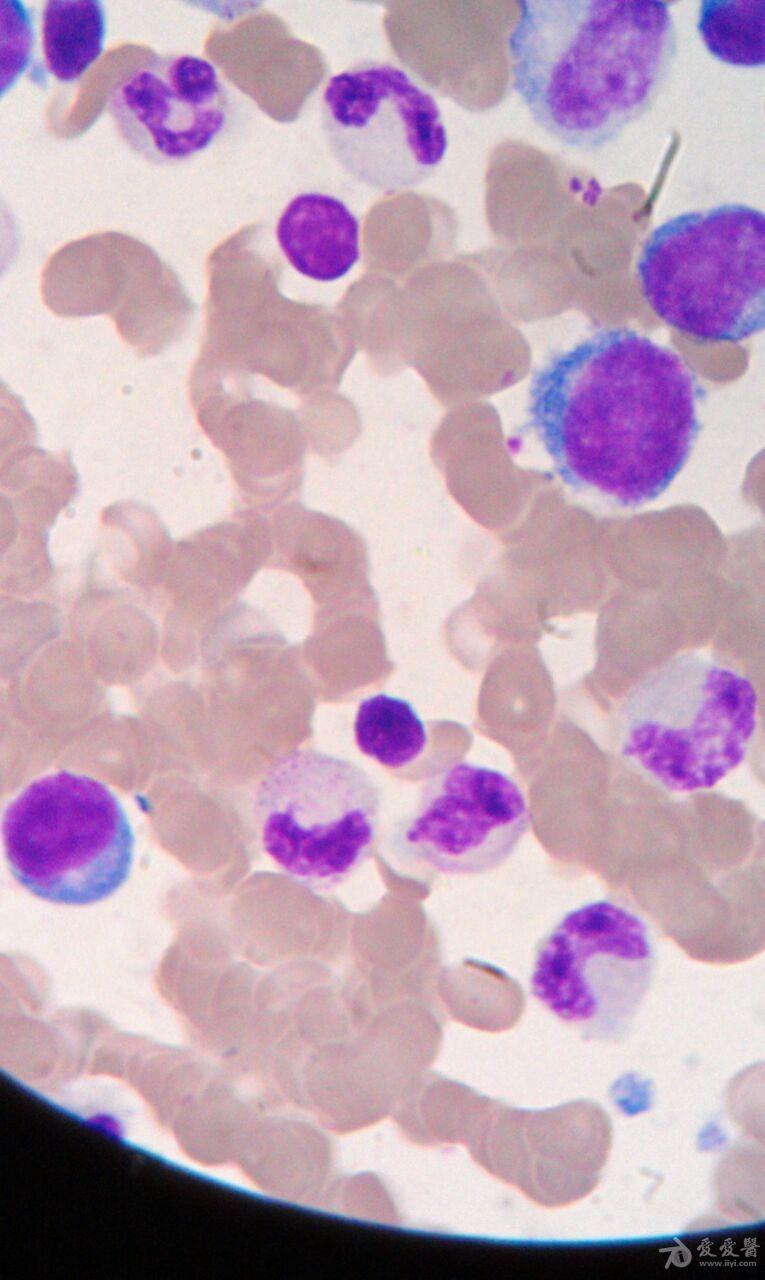 血液细胞形态学求助