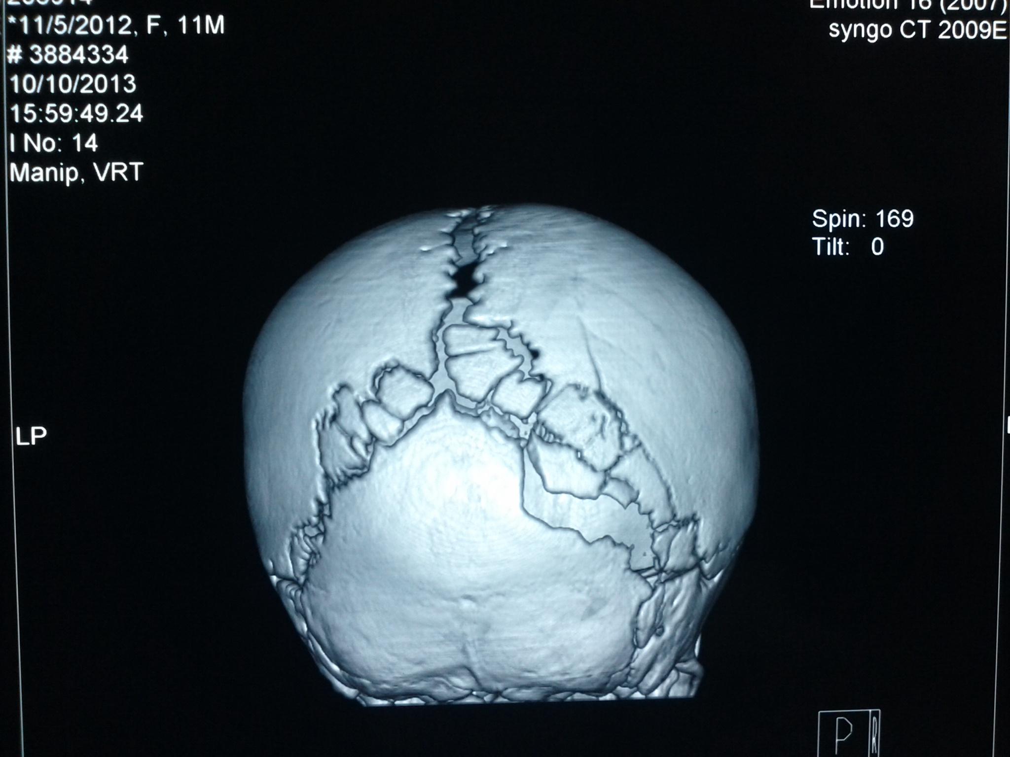 10月10日三维重建