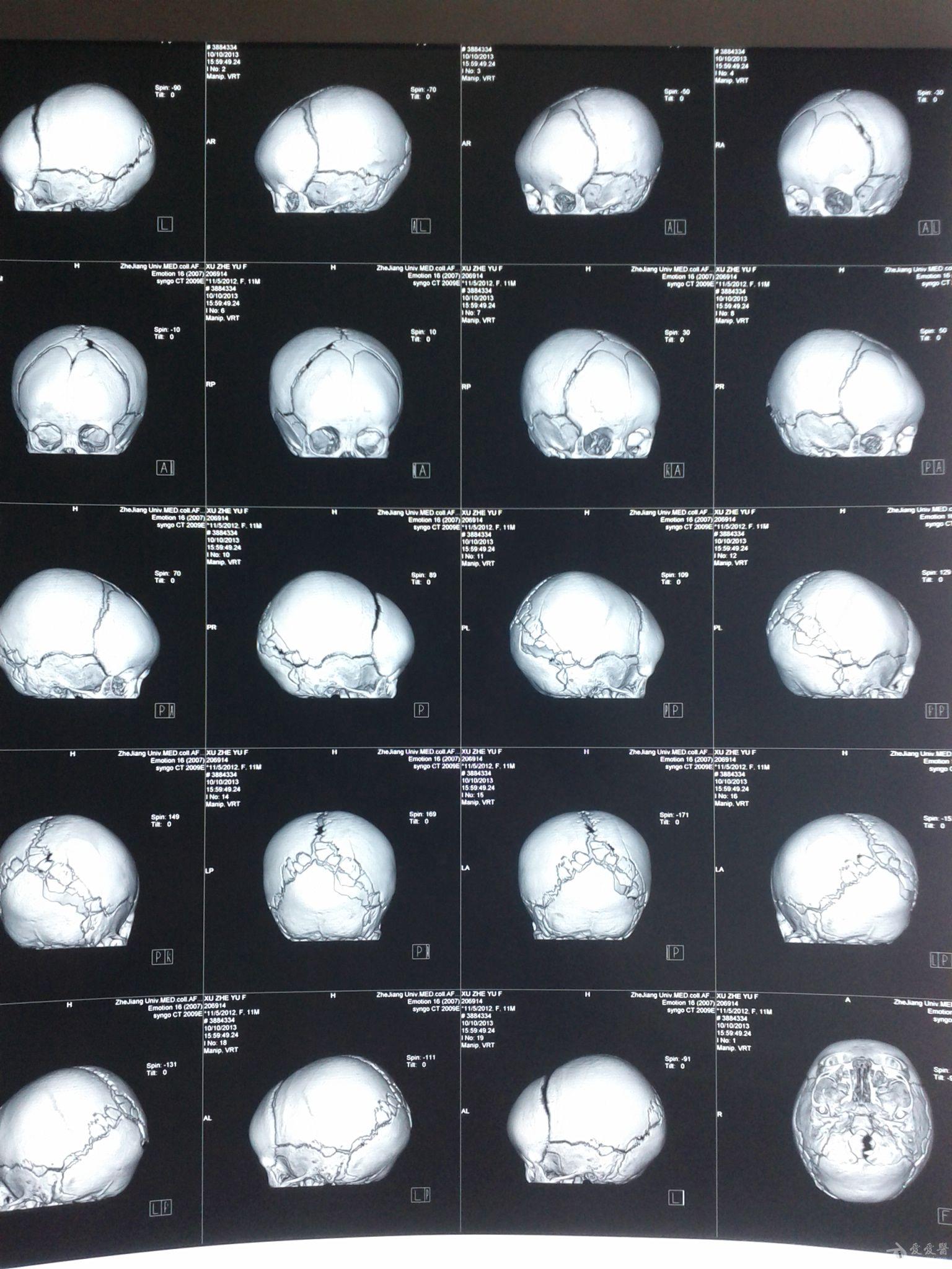 10月10日三维重建