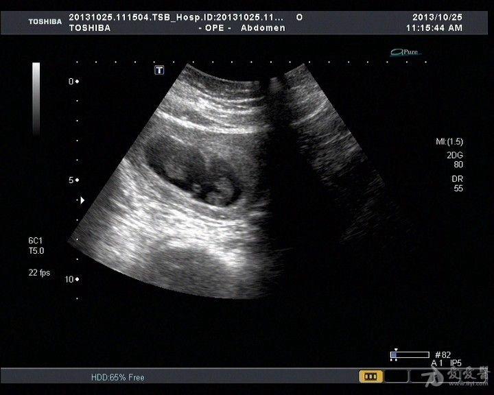 大家看一看是单绒还是双绒双羊啊死胎