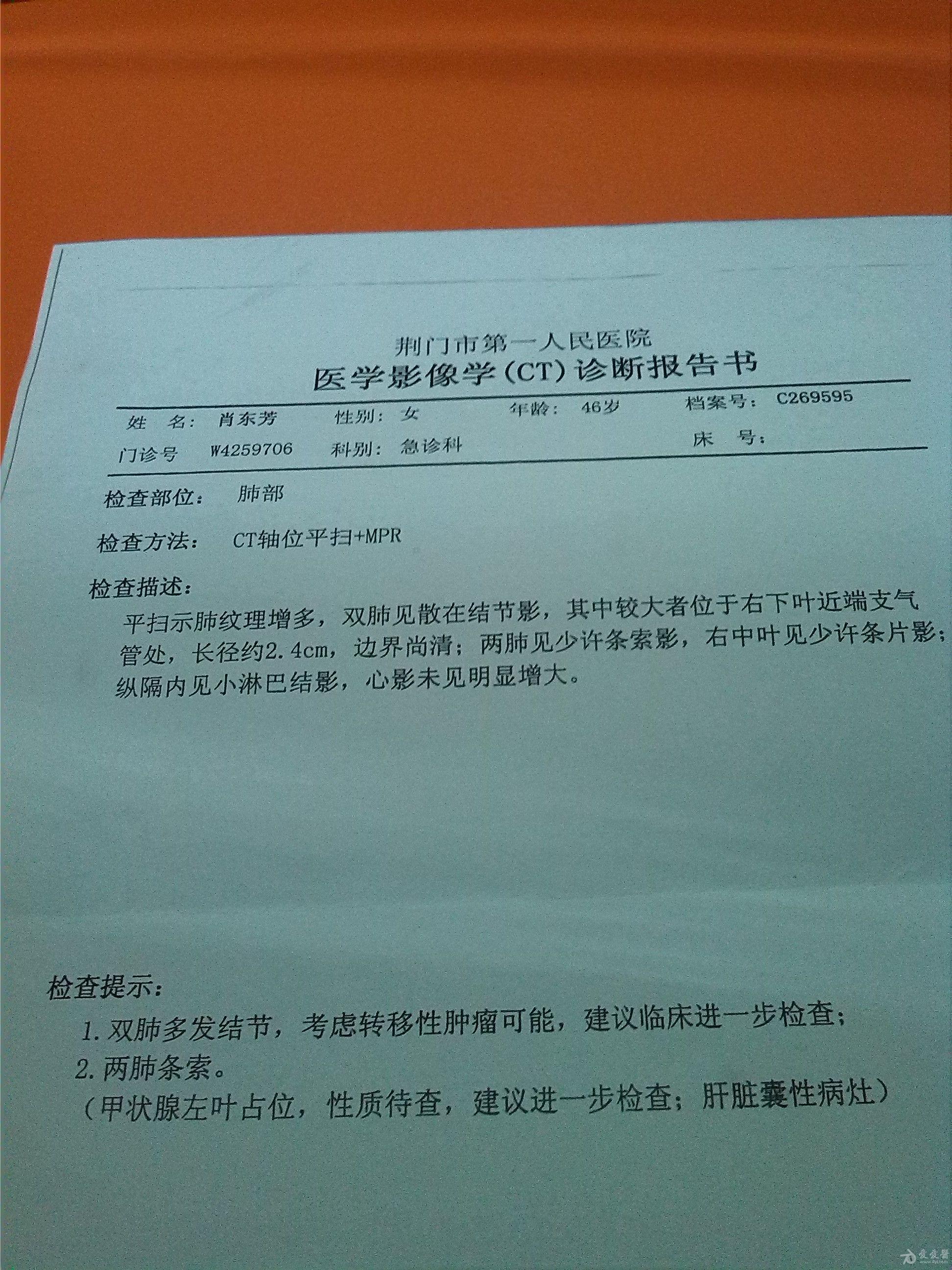 肺部ct