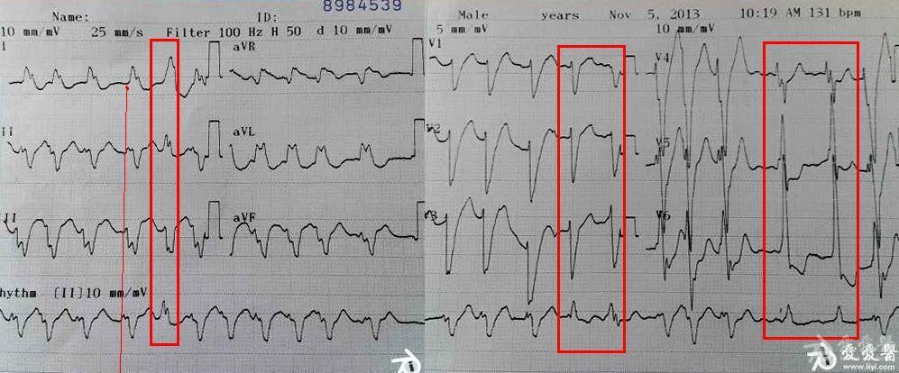 心電圖腦電圖專業討論版 - 愛愛醫醫學論壇