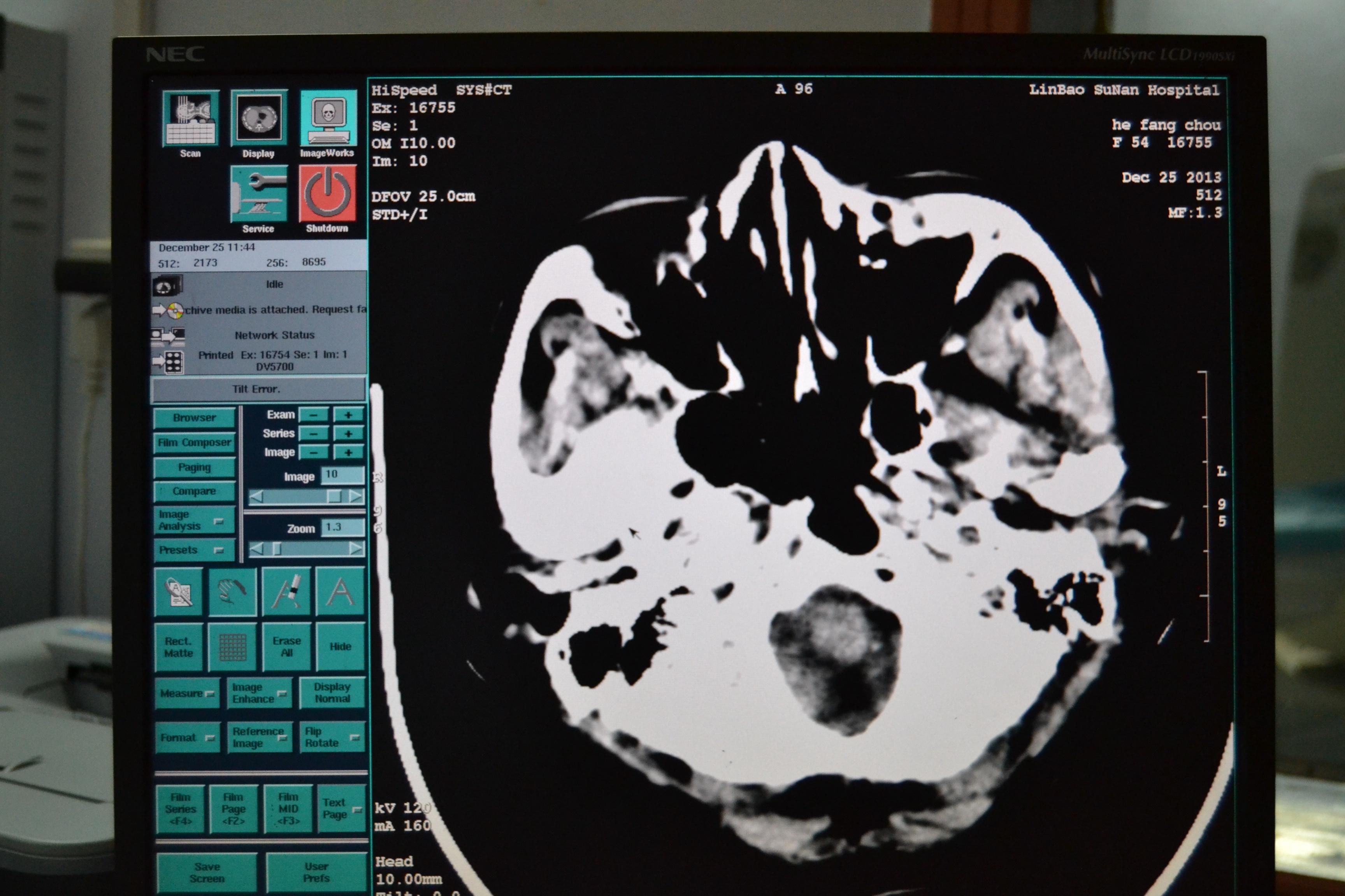 其他有哪位老师帮忙看看鼻窦啊
