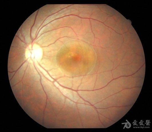 关于收集眼科原创图片的活动