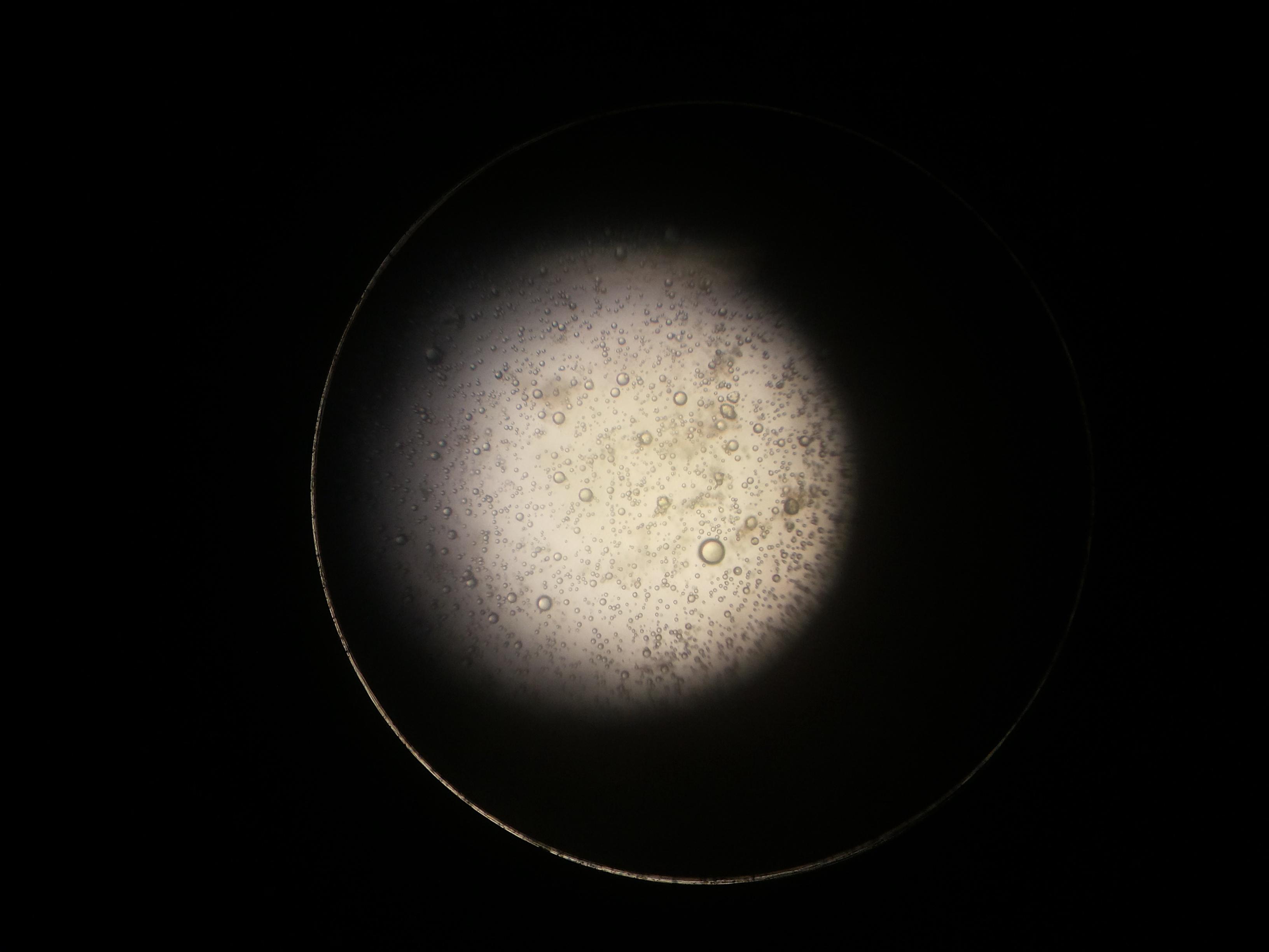 大便霉菌镜检图片图片