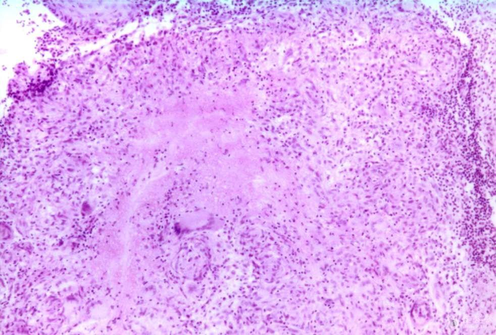 草莓舌是什么样的有图片吗 1312161323958c97229aff8e96.jpg