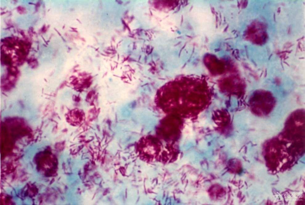 图3-44麻风杆菌(抗酸阳性 x40).jpg