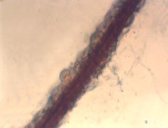 显微镜下的腋毛癣图片