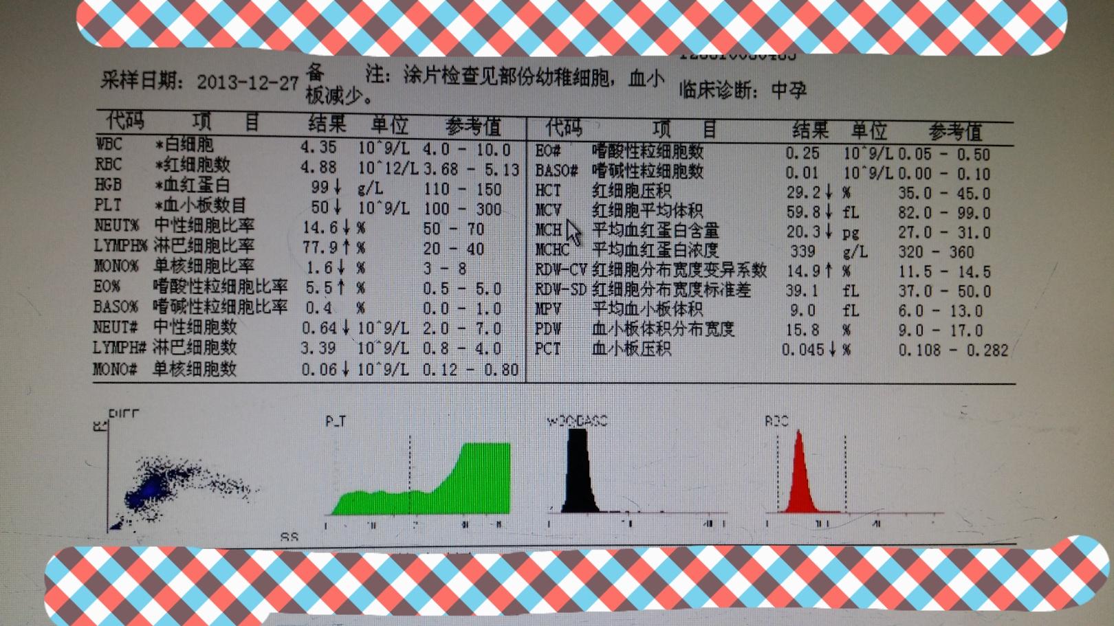 孕14周血小板减少