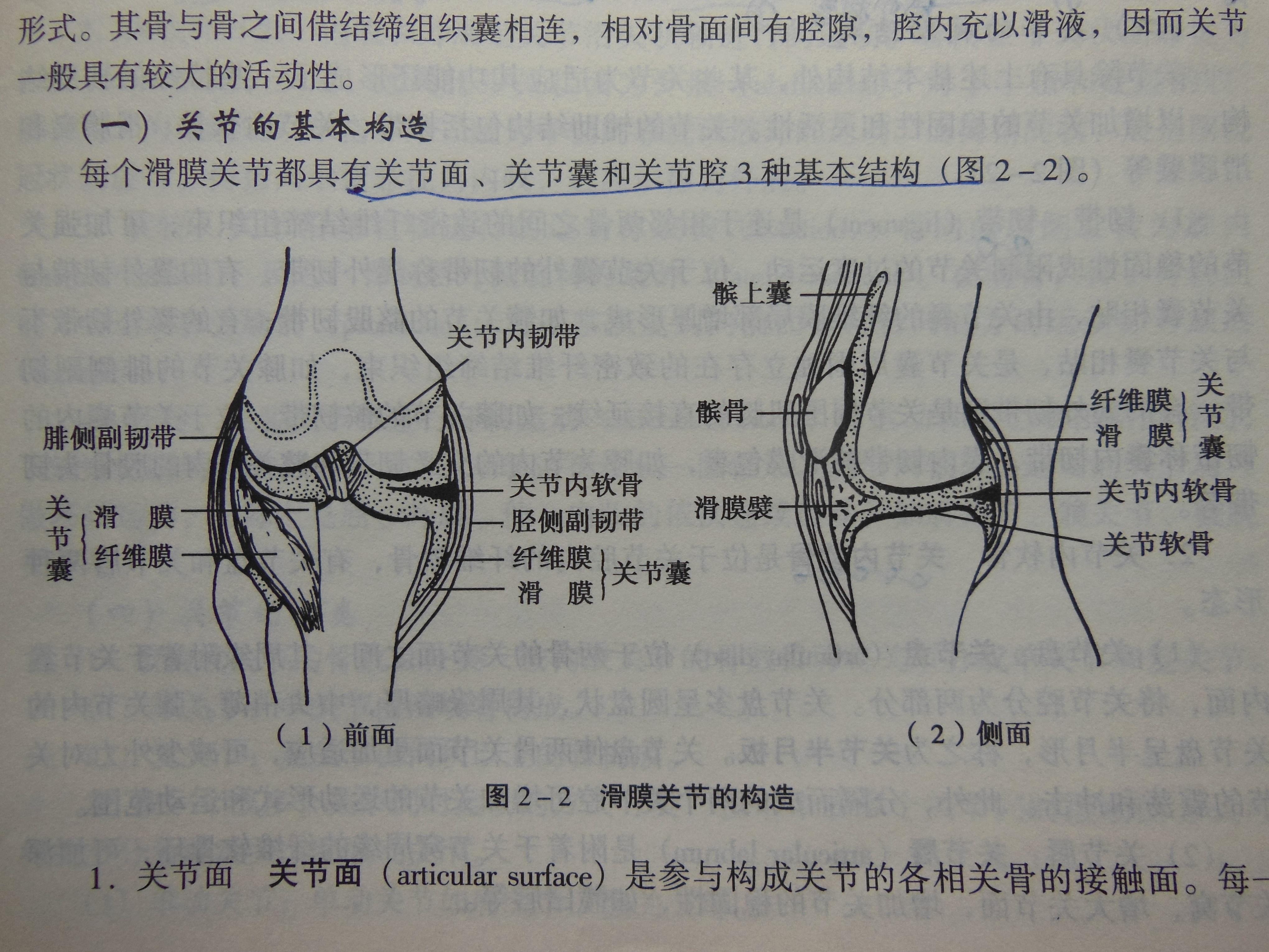 膝關節腔積液伴軟骨損傷