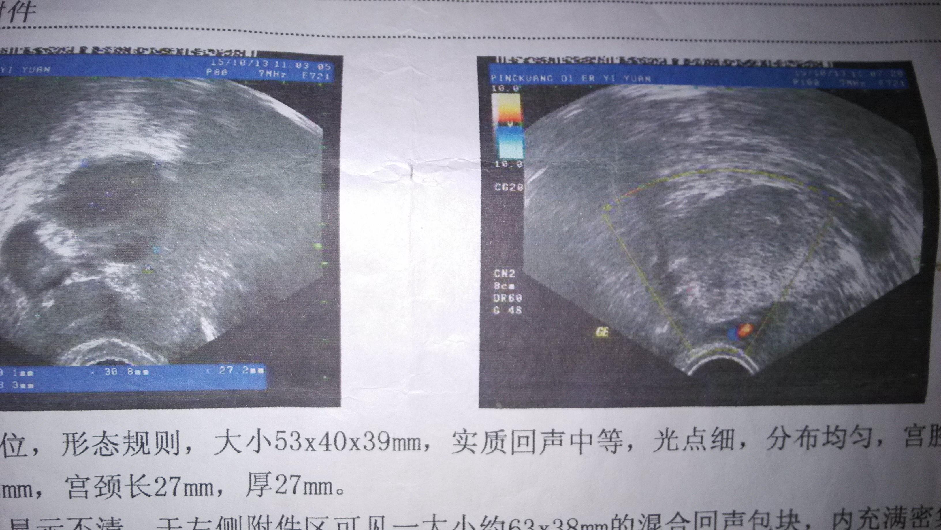 10月15阴超图