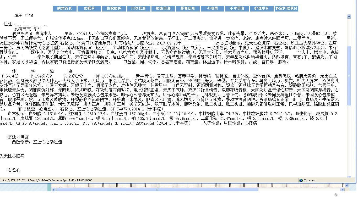 请山羊老师和版主看看,右位心的心电图-是右旋心吗