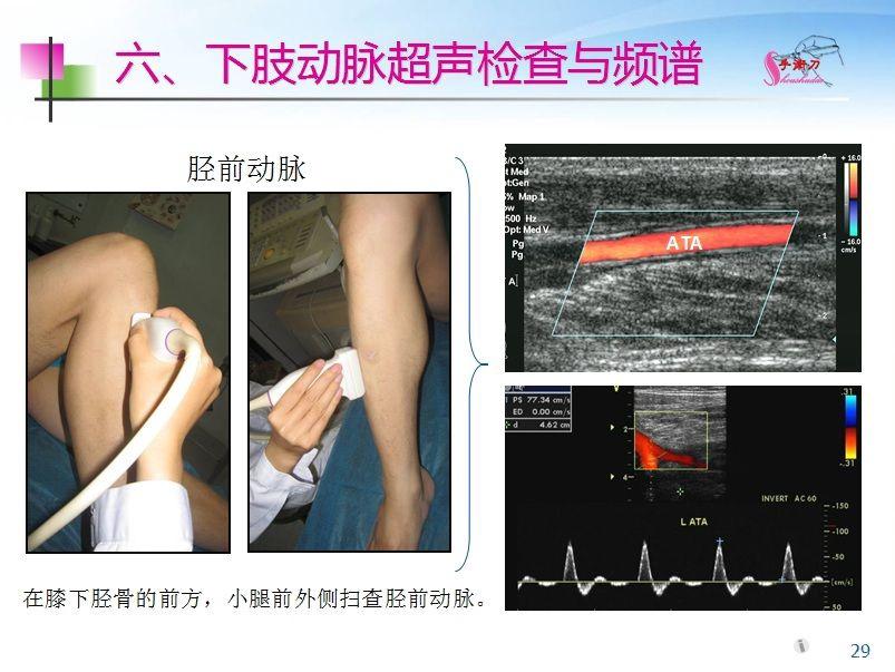 超声下肢血管解剖图谱图片